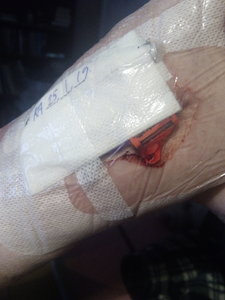 piccline.jpg piccline.jpg